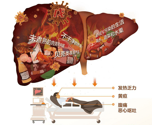 上海每年发病率最高的戊型肝炎，我们如何护肝并做好预防消毒服务